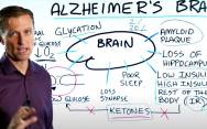 Причины болезни Альцгеймера. Профилактика болезни Альцгеймера